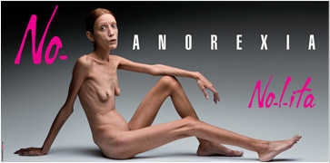 anorexia